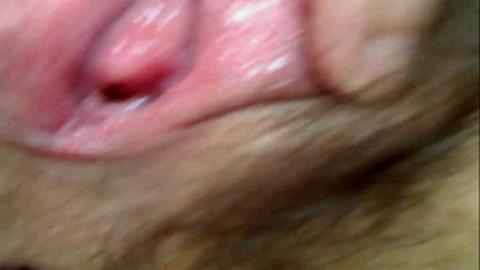 9566